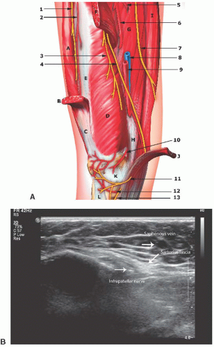 Ultrasound-Guided Saphenous Nerve Block of the Thigh, Knee, and Ankle