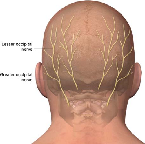 injections-for-headache-occipital-nerve-blocks-and-botulinum-toxin