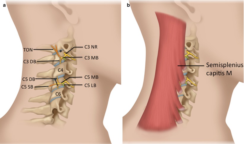 ultrasound-guided-cervical-facet-nerve-blocks-medial-branch-and-third