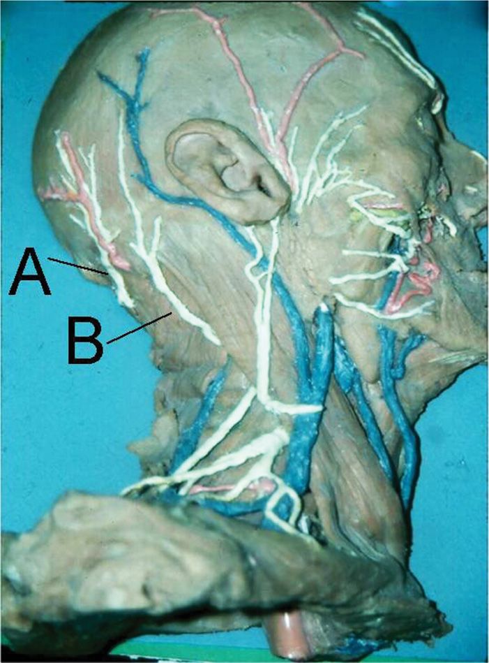 Occipital Nerve Blocks | Anesthesia Key
