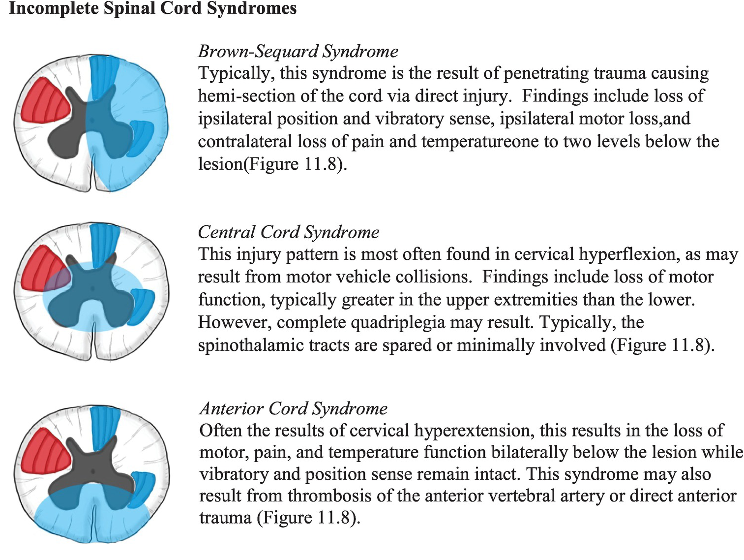 chapter-11-thoracolumbar-trauma-anesthesia-key