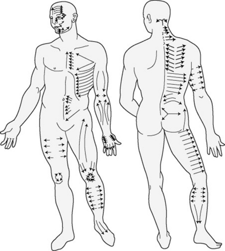 Modalities working with massage | Anesthesia Key