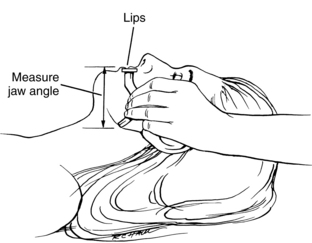 oropharyngeal airway measurement