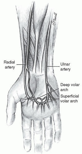 radial arterial line