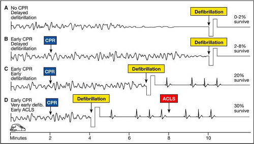 Defibrillation Practice Anesthesia Key 