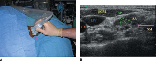 Pediatric Ultrasound | Anesthesia Key