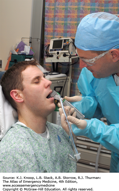 AIRWAY | Anesthesia Key