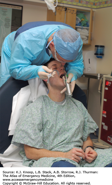 AIRWAY | Anesthesia Key