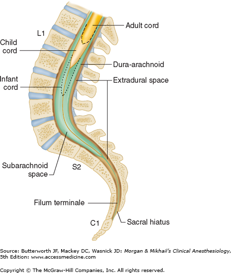 Spinal, Epidural, & Caudal Blocks | Anesthesia Key