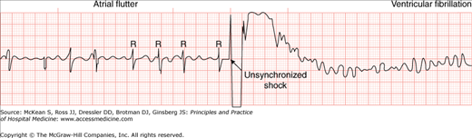 Cardioversion Anesthesia Key 