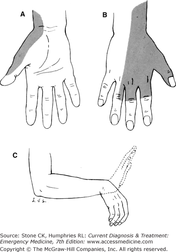 Hand Trauma | Anesthesia Key