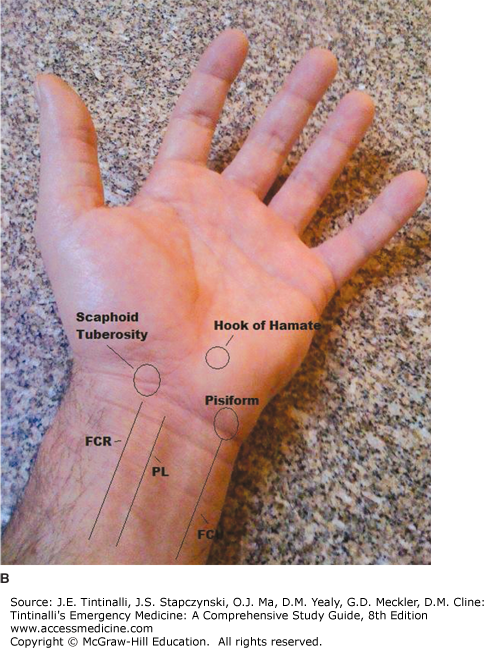 wrist surface anatomy