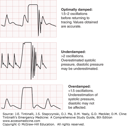 Hemodynamic Monitoring | Anesthesia Key