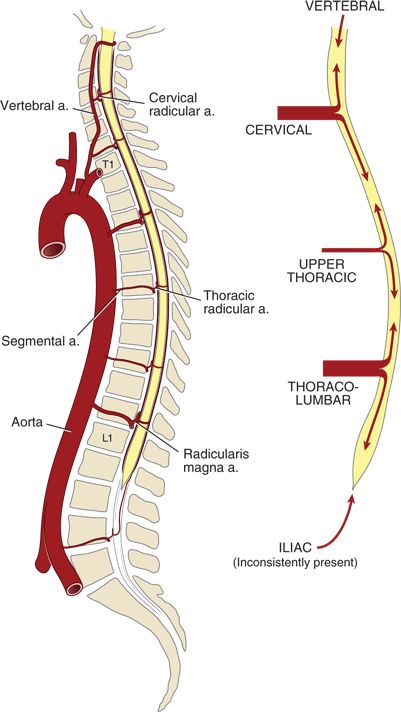 Neuraxis Ischemic Injury | Anesthesia Key