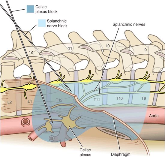Anatomy of the celiac plexus and splanchnic nerves. 