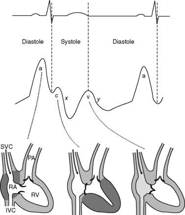 Hemodynamic Monitoring | Anesthesia Key