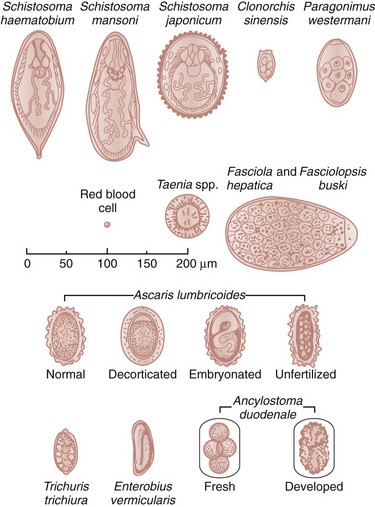 Parasitic Infections