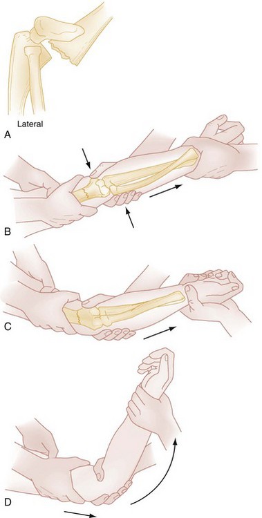 Musculoskeletal Disorders Anesthesia Key