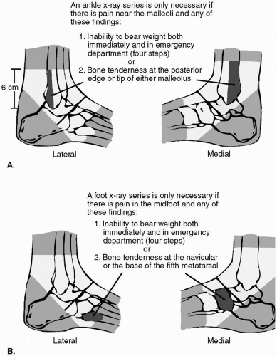 Orthopedics | Anesthesia Key