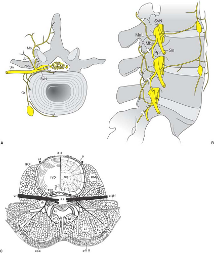 Spinal Pain and the Role of Neural Blockade | Anesthesia Key