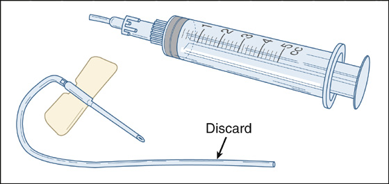 Figure 1 from Safe and effective ear irrigation.