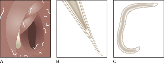 Human Pinworm Tape Test