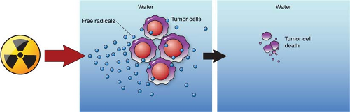 radiation-therapy-anesthesia-key