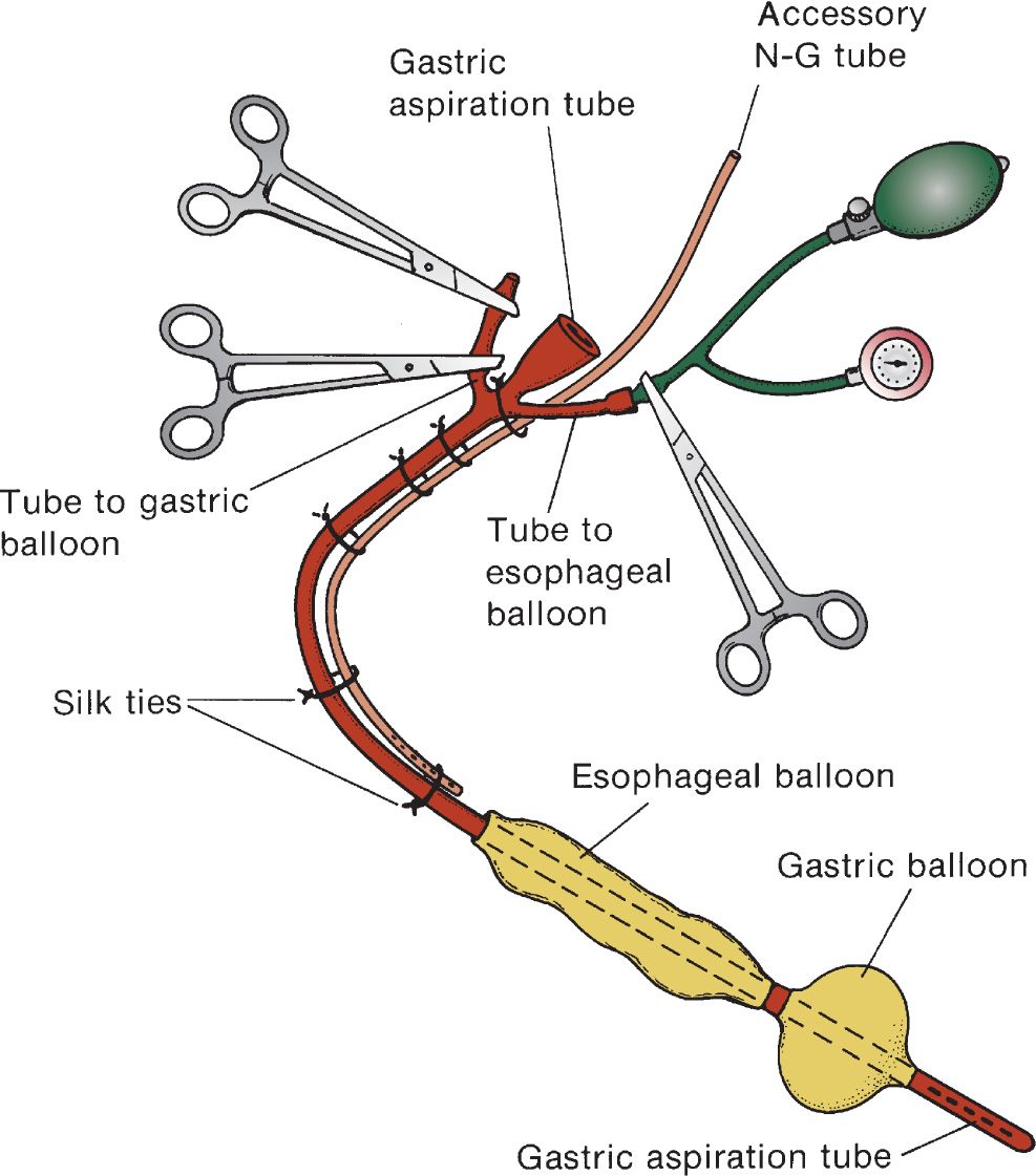 sengstaken blakemore tube inflation