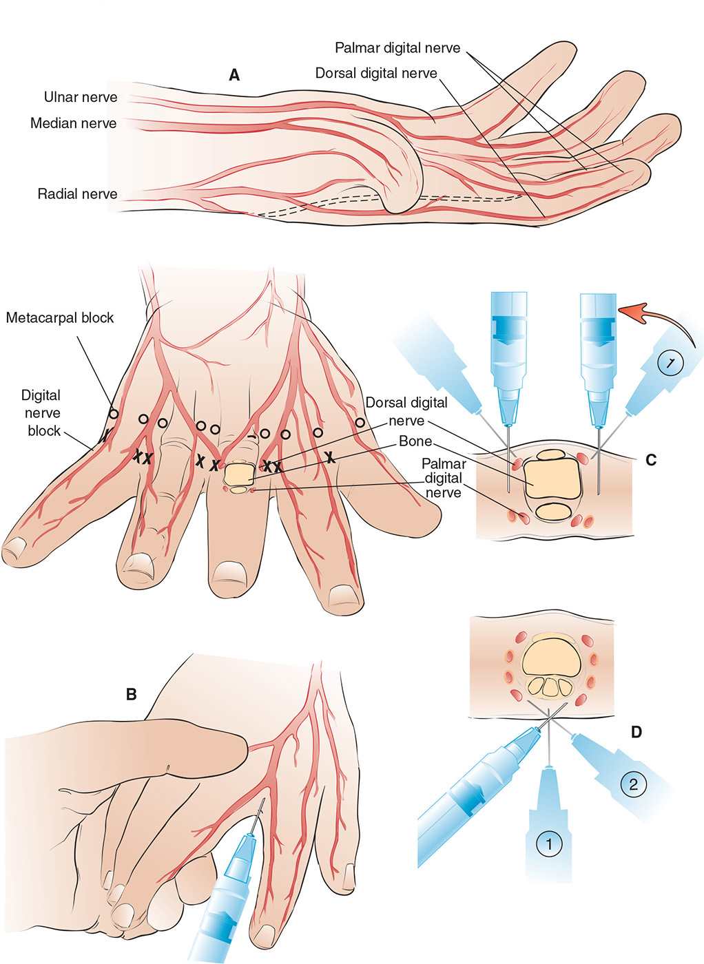 how-long-does-a-digital-nerve-block-last-digital-photos-and