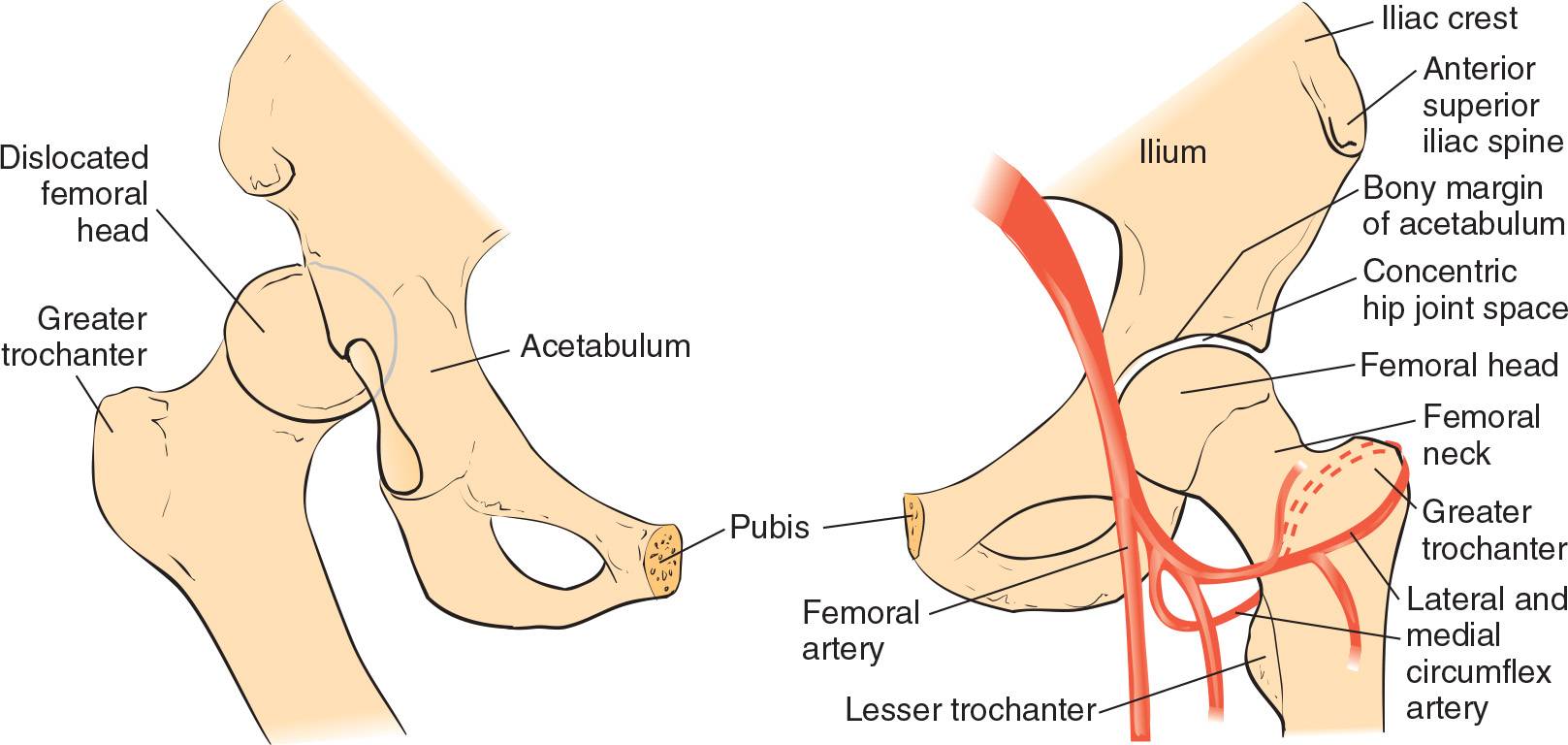 posterior hip dislocation presentation