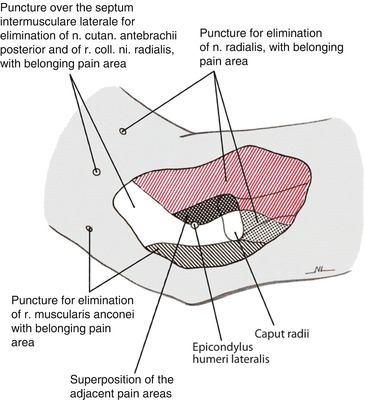 A322505_1_En_1_Fig1_HTML.jpg