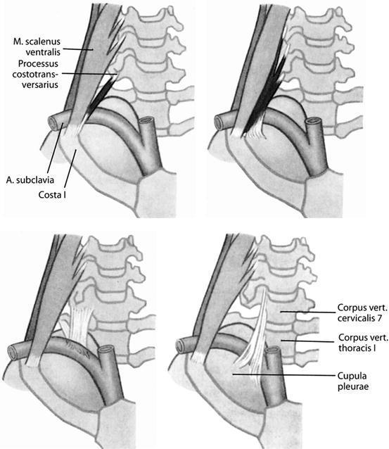 A322505_1_En_5_Fig2_HTML.jpg