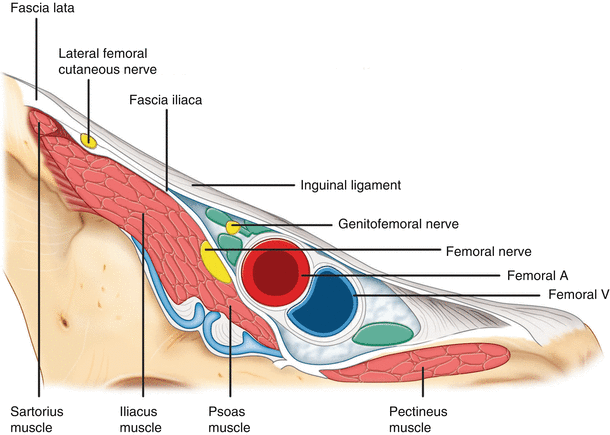 Lateral Femoral Cutaneous Nerve Block Anesthesia Key Lateral Femoral Cutaneous Nerve Block Anesthesia Key