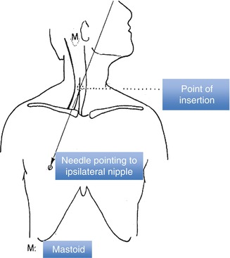 A330693_1_En_10_Fig1_HTML.jpg