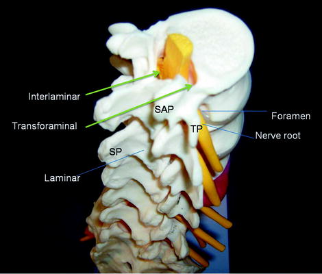 A978-1-4419-1651-8_30_Fig10_HTML.jpg