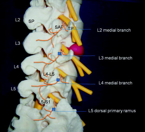 A978-1-4419-1651-8_30_Fig3_HTML.jpg