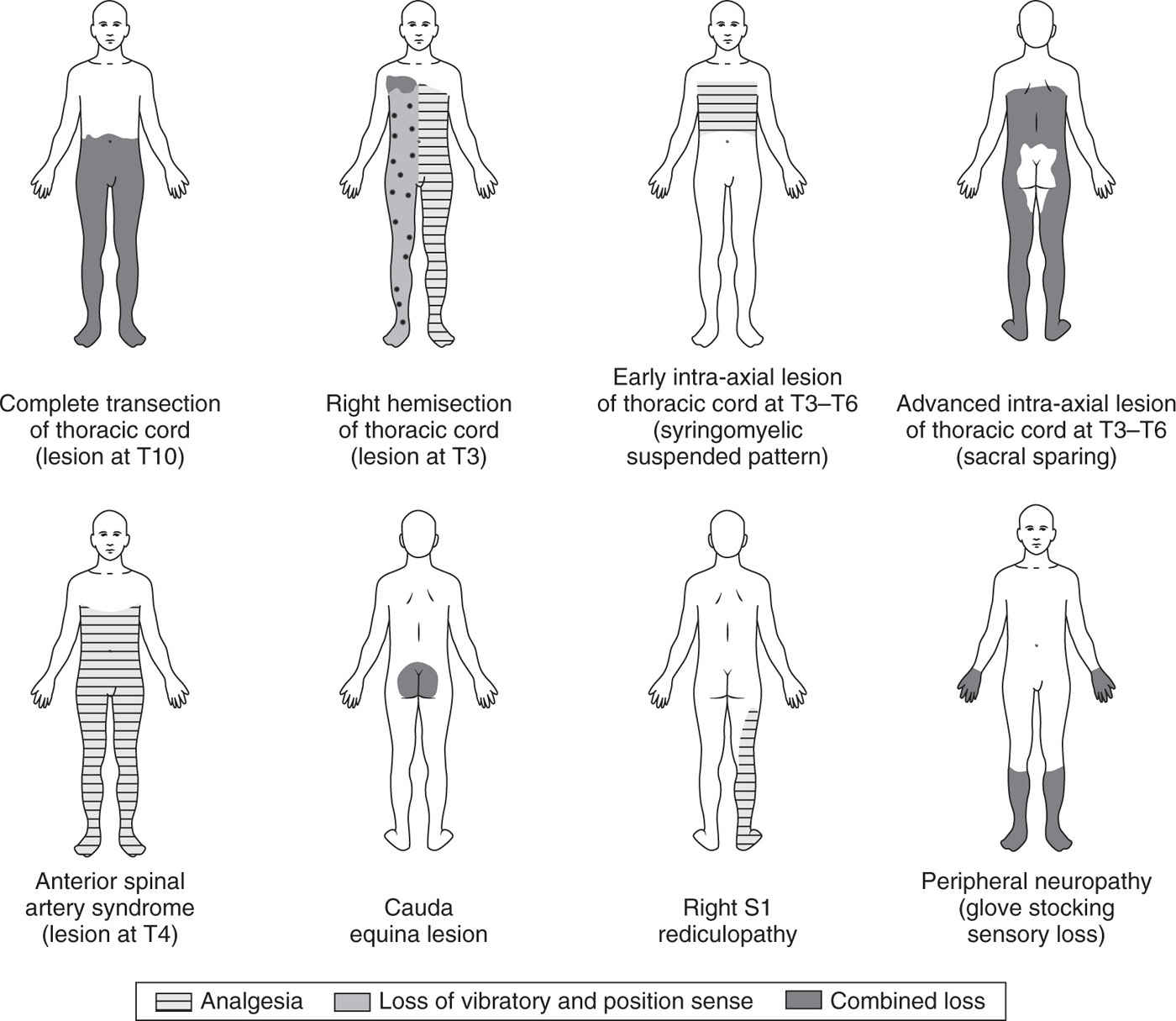 Nervous System Disorders—5% | Anesthesia Key