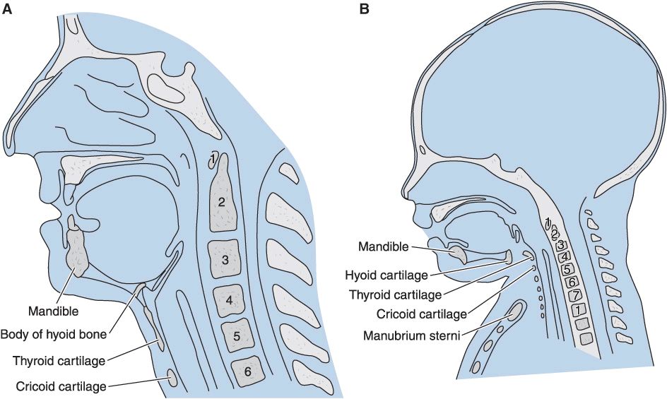 Adult Vs Pediatric Airway Anatomy