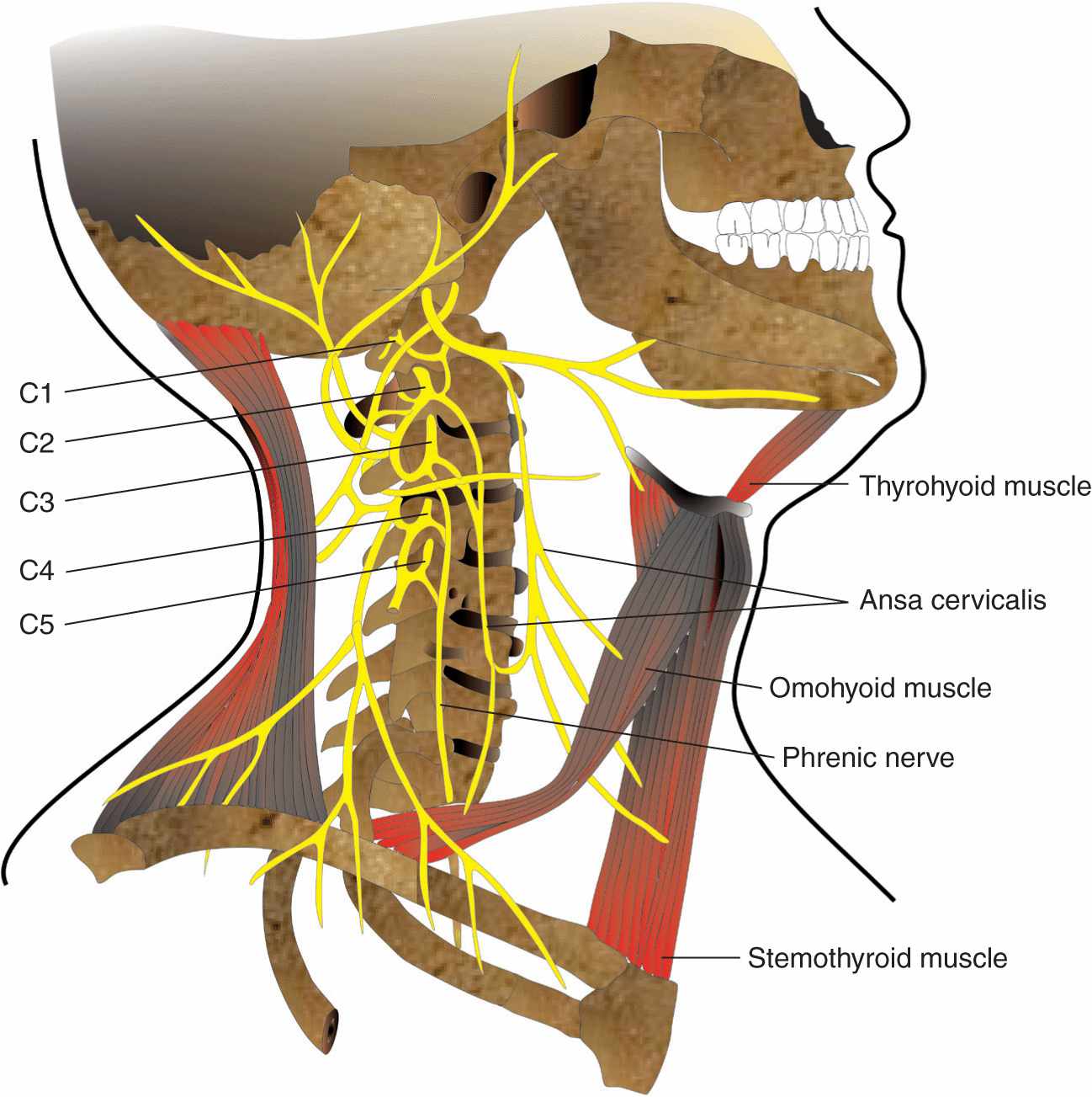 cervical-plexus-block-anesthesia-key