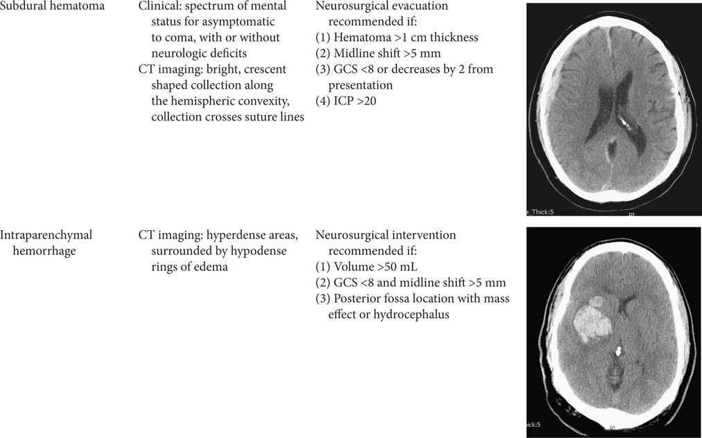 Severe Traumatic Brain Injury Anesthesia Key