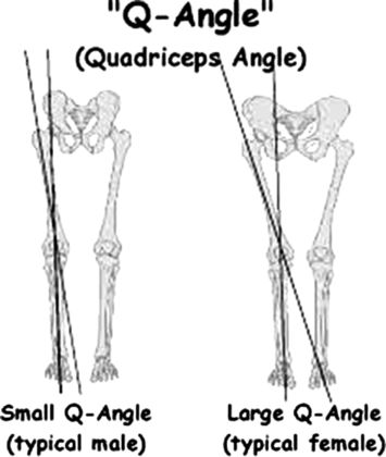 Abnormal Q Angle