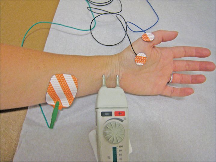 how painful is emg nerve testing