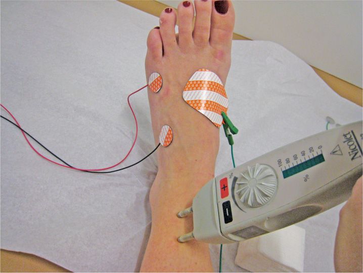 nerve pain with emg test