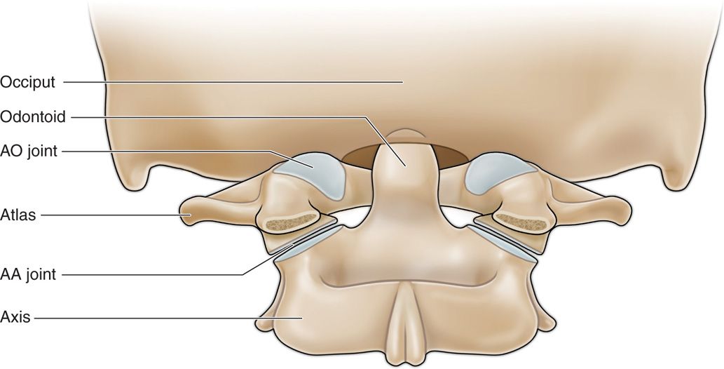 tratament articular atlanto occipital