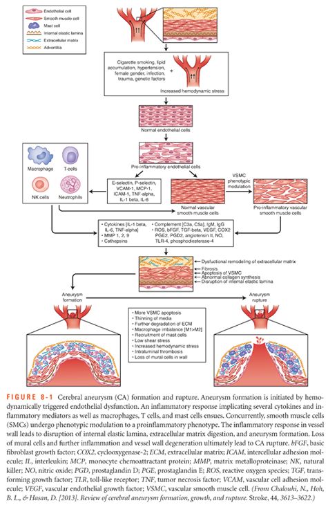 SAH Management Algorithm – Peripheral Brain