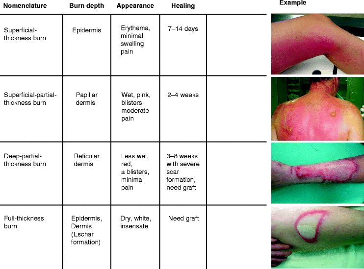 thickness burn vs 4th degree burn