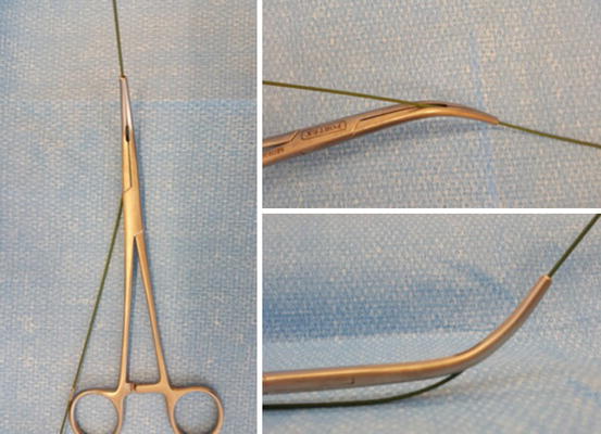 Percutaneous Tracheostomy: The Guide Wire Dilating Forceps Technique ...