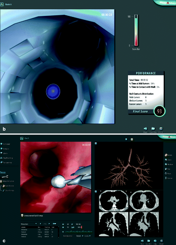 A978-1-4614-5993-4_16_Fig8b_HTML.gif