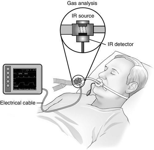 capnography device