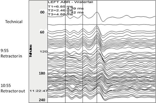 A210707_2_En_25_Fig4_HTML.gif